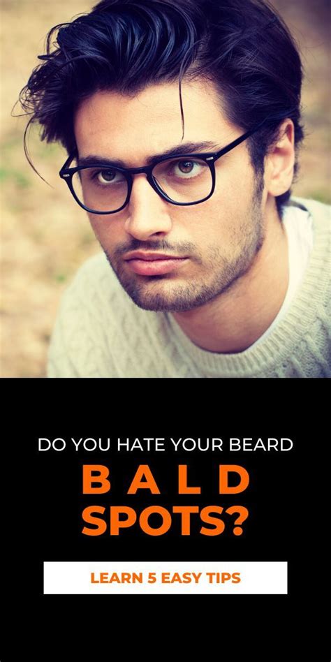 Check spelling or type a new query. Struggling With Beard Balding? | How To Fix A Patchy Beard ...