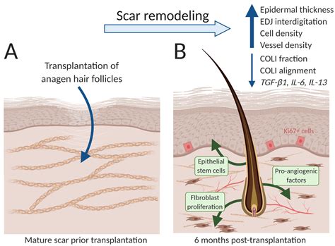Scars Mended Using Transplanted Hair Follicles In Imperial College