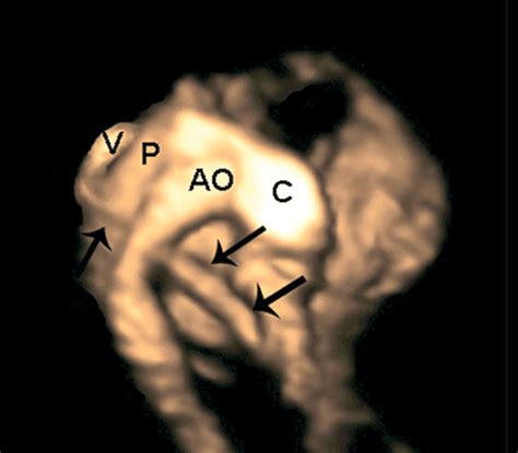 B Flow Spatiotemporal Image Correlation Image Showing The Spatial