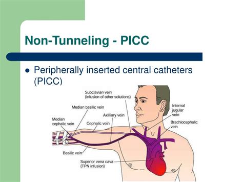 Ppt Venous Access Powerpoint Presentation Free Download Id349907