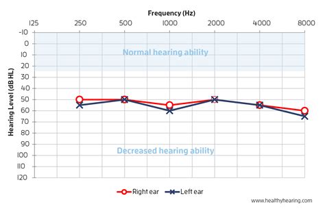 Help With Suitable Aids For My Hearing Loss Hearing Aids Hearing