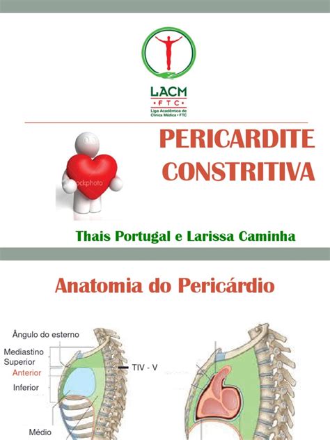 A pericardite constritiva é uma entidade clínica rara que pode colocar problemas diagnósticos. Pericardite Constritiva | Coração | Tórax (Anatomia Humana)