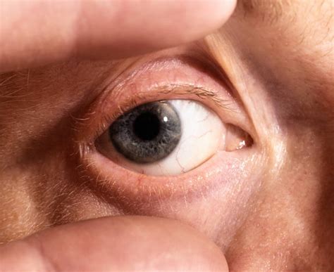 Holding Eye Lids Open Stock Photos Pictures And Royalty Free Images Istock