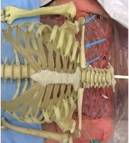 Anatomy Dissection 2 Flashcards Quizlet