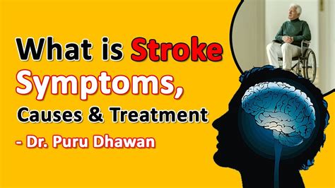 What Is Stroke Symptoms Causes And Treatment Youtube