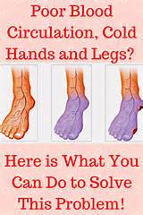 Images of Home Remedies For Better Blood Circulation