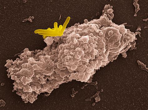 Macrophage Engulfing Bacteria Sem Photograph By Pixels