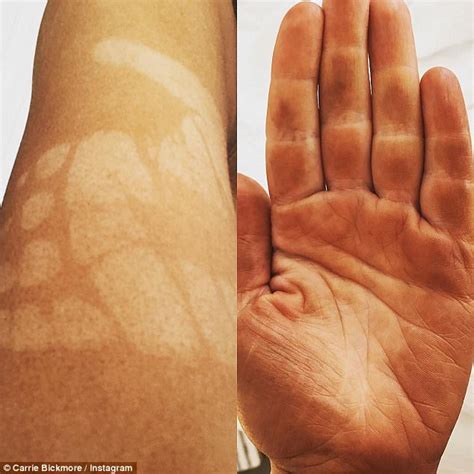 The Project S Carrie Bickmore Suffers A Fake Tan Fail Daily Mail Online