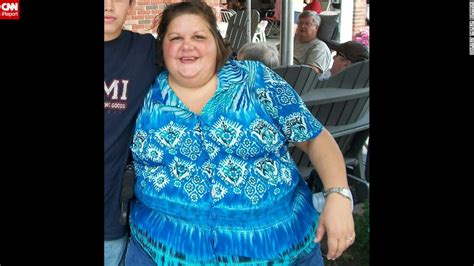 I Couldnt Walk Woman Loses 276 Pounds Cnn