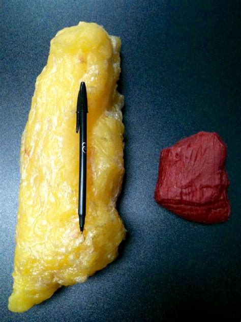 Fat Vs Muscle Understanding The Truth Behind The Images