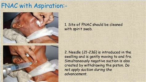 Fine Needle Aspiration Cytology Fnac