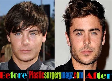 He doesn't need plastic surgery either but a lot of fans believe he already did. Zac Efron Nose Job Before and After Pictures | Plastic ...