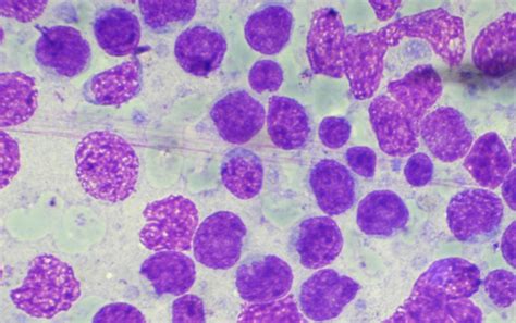 Lymphoma most commonly arises from lymphoid tissues in the bone marrow, thymus, lymph nodes, or spleen. Lymphoma in Dogs and Cats | Vet4Life