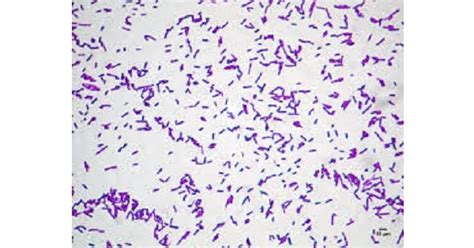 Bacillus Cereus New