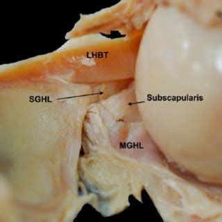 The glenohumeral joint has the following supporting structures Right shoulder showing the superior (SGHL), middle (MGHL) and inferior... | Download Scientific ...