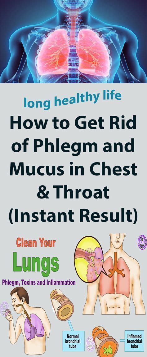 Home Remedies To Get Rid Of Phlegm Mucus Color Chart