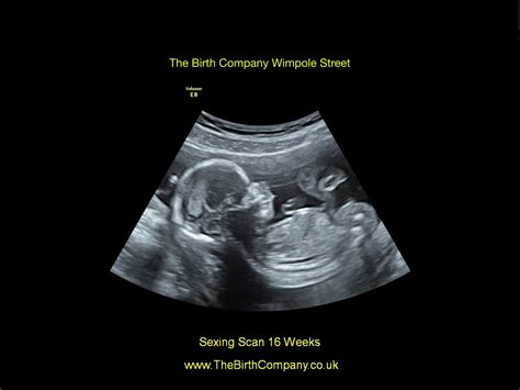 Sexing Scan £185 Gender Scan Harley Street London The Birth Company