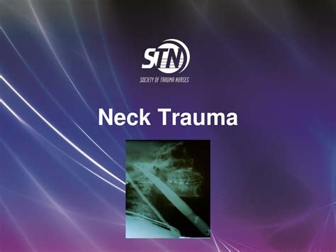 Ppt Neck Trauma Powerpoint Presentation Free Download Id2046178