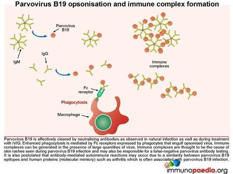 Parvovirus B19 Case Study Immunopaedia