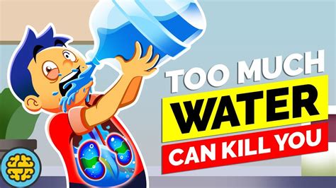 Video The Dangers Of Drinking Too Much Water