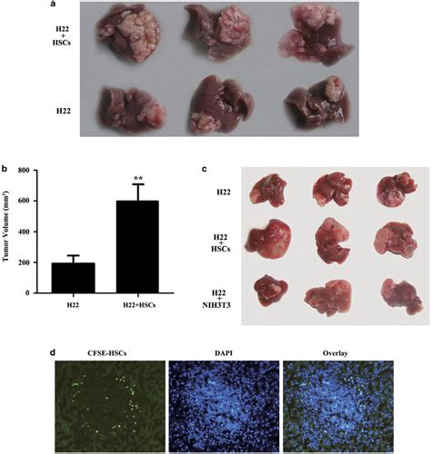 Hepatic Stellate Cells Hscs Promoted The Growth Of Hepatocellular