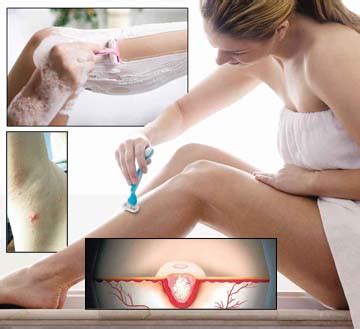 Ketuat filiform (yang mempunyai benang) dan ketuat rata adalah mereka yang mempunyai. info..info..info..: May 2013