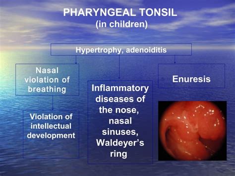 Anatomy And Physiology Of Pharynx Tonsillitis