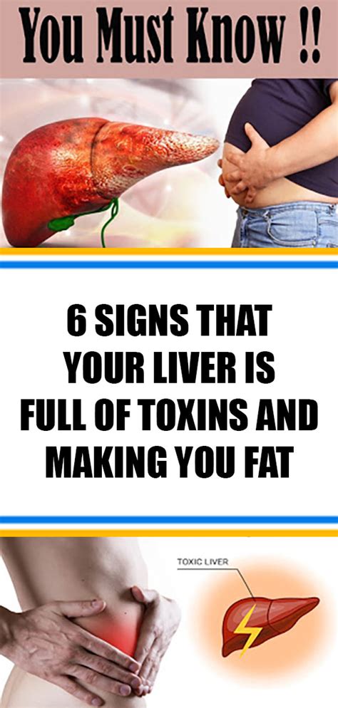 6 Signs That Your Liver Is Full Of Toxins And Making You Fat And How