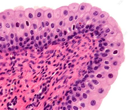 Urinary Bladder Transitional Epithelium Light Micrograph Stock Image