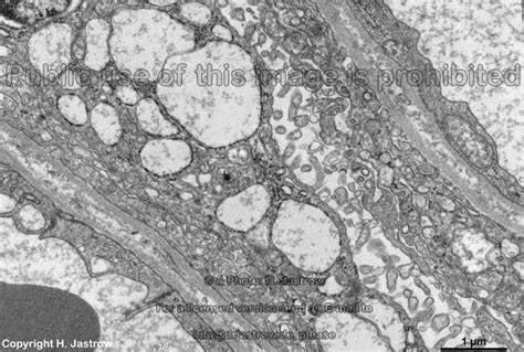 Wie kommt sauerstoff ins blut? Blut Luft Schranke Dicke - bucherregal