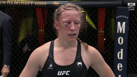 Pic Fighter Suffers Brutal Eye Injury At Ufc Vegas 32