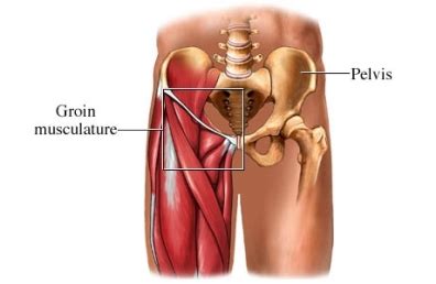 Hip flexor strains occur when hip flexor muscles are stretched or torn. Groin Strain - PT & ME