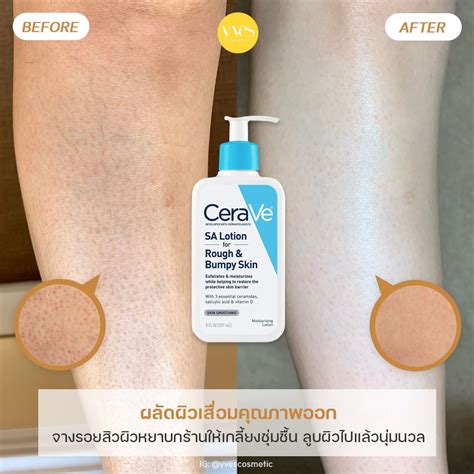 Cerave Sa Lotion For Rough And Bumpy Skin Yvescosmetic