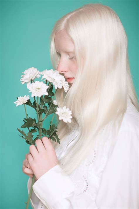 Albino People Wholl Mesmerize You With Their Otherworldly Beauty