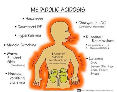 Master Nursing Management Of Metabolic Acidosis