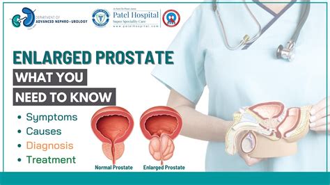Bph Symptoms Causes Diagnosis Treatment Prostate Health Patel