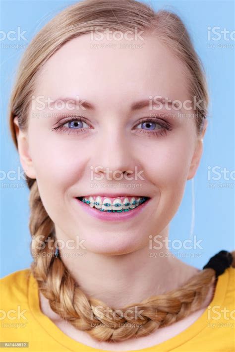 Woman Showing Her Teeth With Braces Stock Photo Download Image Now