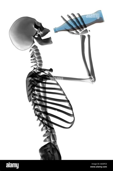 X Ray Skeleton Drinking Soda Stock Photo 3778252 Alamy