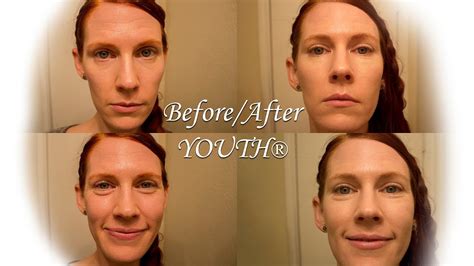 After Youth ~ Shaklees New Skin Care Line Before And After Youtube