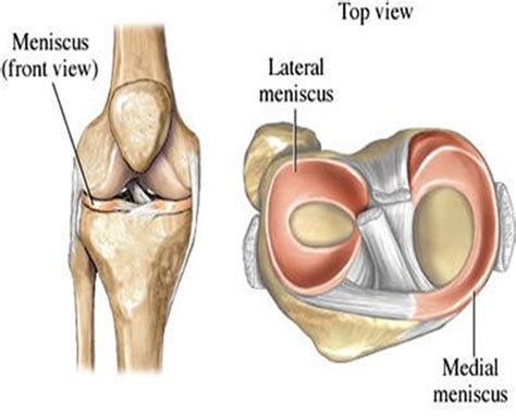 Medial Meniscus Anatomy