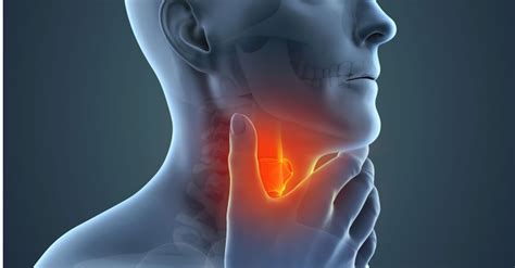 Head And Neck Cancer Causes Symptoms Diagnosis And Treatment