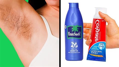 Removed My Armpit Hair Permanently Body Hair Removalhow To Get Rid Off
