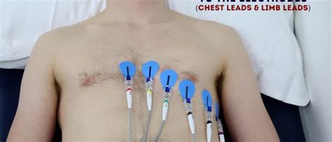How To Record An Ecg Osce Guide Procedure Geeky Medics