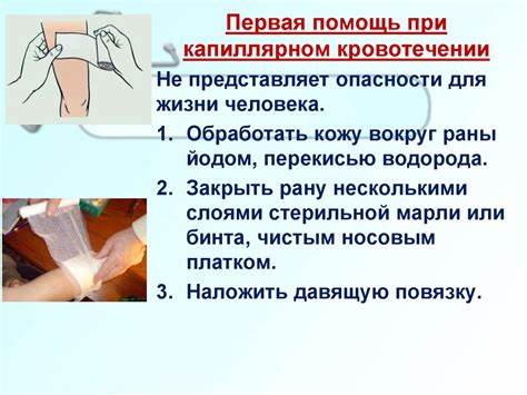 Диета маточное кровотечение Первая помощь при кровотечениях - презентация онлайн Первая помощь при кровотечениях - презентация онлайн Диета маточное кровотечение