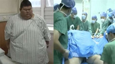 ‘china’s Fattest Man’ Undergoes Weight Loss Surgery Hopes To Become A Personal Trainer By