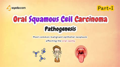 Oral Squamous Cell Carcinoma Pathogenesis