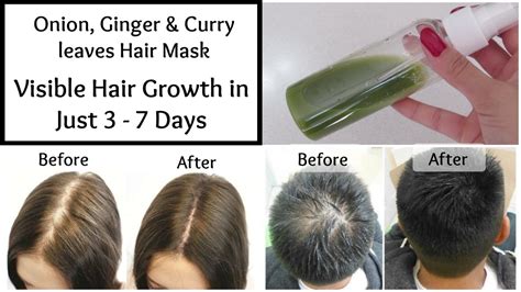 This may also cause hair loss. Visible Hair Growth in just 3 Days || Onion, Ginger ...
