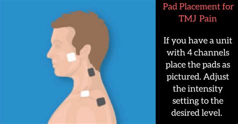 If you've recently brought home a tens unit to help with your muscle pain, you're probably wondering where exactly to place the electrode pads. Pin on Tens placements