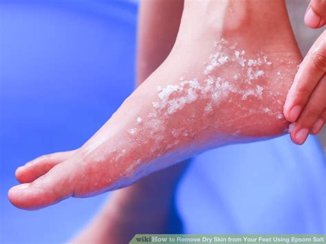 How To Remove Dry Skin From Your Feet Using Epsom Salt