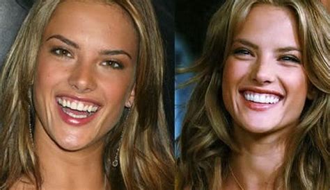 Alessandra Ambrosio 544×340 Teeth Before And After Pinterest